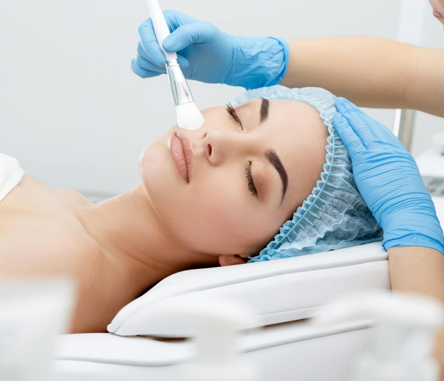 Peeling léger ou peeling doux : le traitement | Genève | Face Clinic